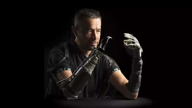 Bridging the Gap: AI Enhances Bionic Hand Functionality for Amputees