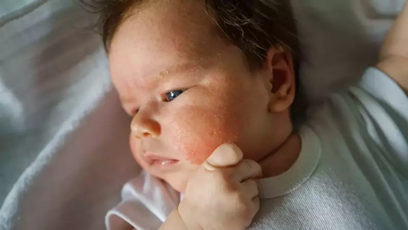 Common Rashes in Children: Identification and Management