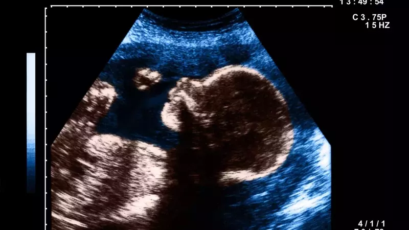 The Art and Impact of Pregnancy Nicknames