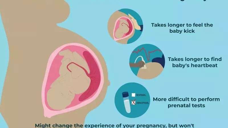 Understanding Anterior Placenta During Pregnancy