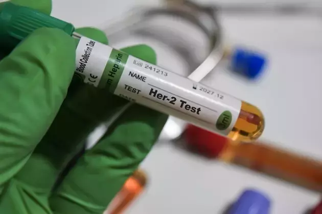 Greenwich LifeSciences: A Promising Immunotherapy for HER2-Positive Breast Cancer