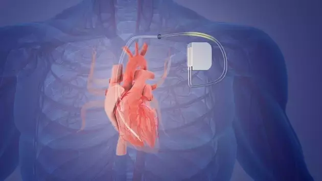 Orchestra BioMed: A Promising Horizon in Medical Device Innovation