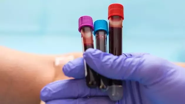 Guardant Health: High Growth, High Valuation, Uncertain Future
