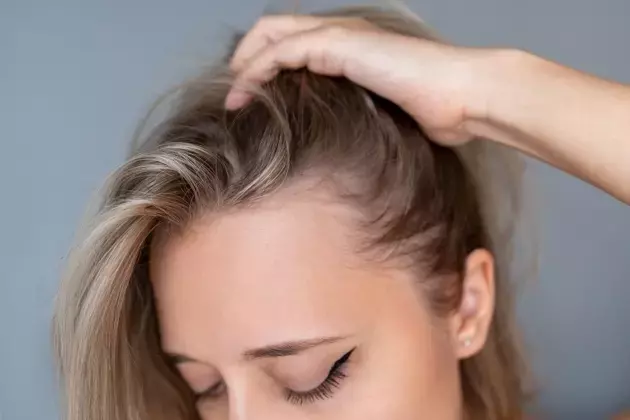 Veradermics: Pioneer in Pattern Hair Loss Treatment with Promising Oral Minoxidil